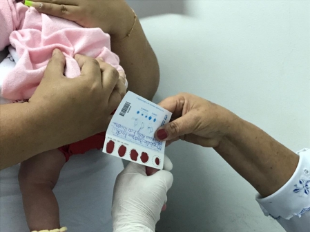 Dia Nacional do Teste do Pezinho será celebrado em Centro de Referência em Duque de Caxias