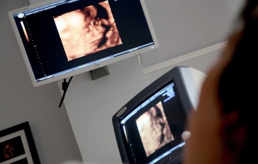 Hospital de Petrópolis recebe aparelhos de ultrassom portáteis