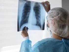 Radiologia no RJ tem mais de 230 unidades com irregularidades