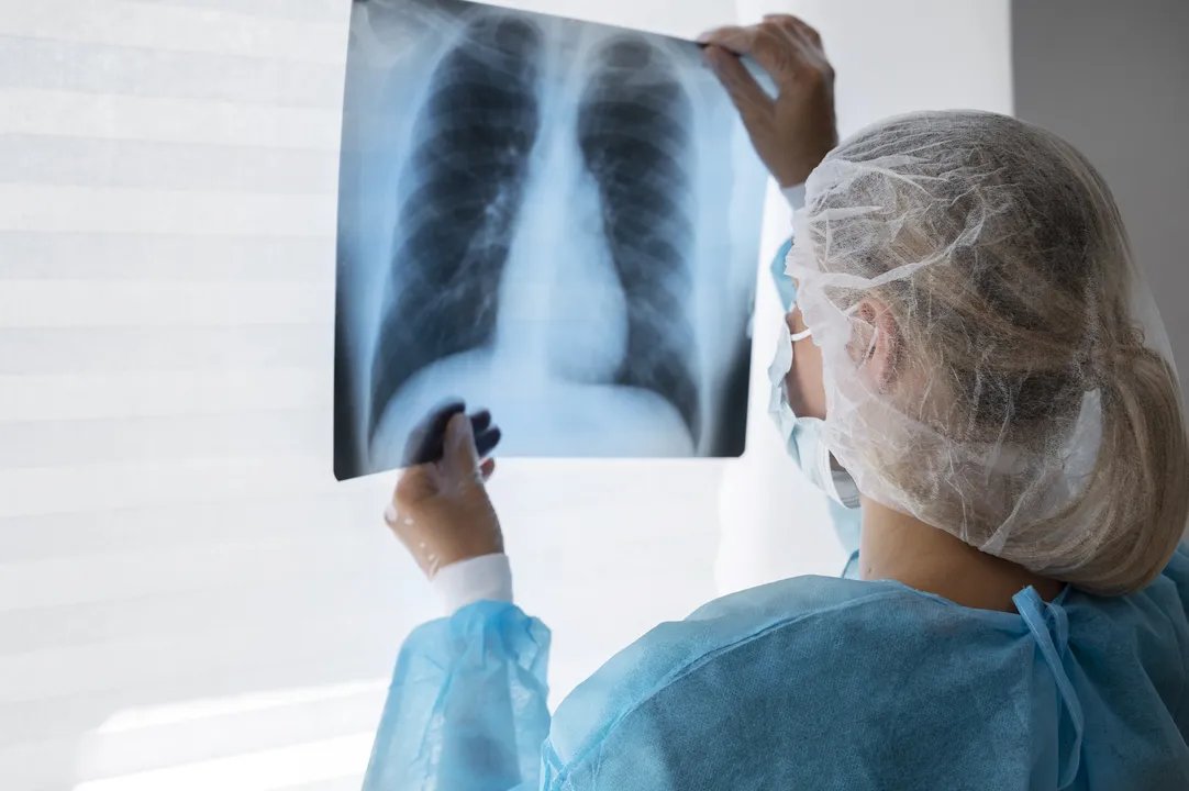 Radiologia no RJ tem mais de 230 unidades com irregularidades
