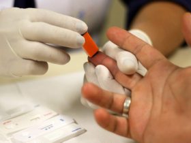 Estado do Rio se destaca na redução de óbitos por hepatites B e C