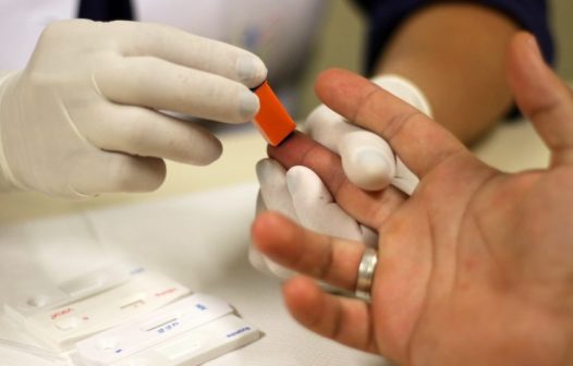 Estado do Rio se destaca na redução de óbitos por hepatites B e C