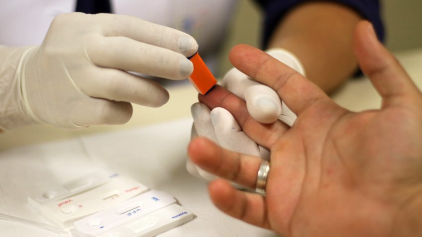 Estado do Rio se destaca na redução de óbitos por hepatites B e C