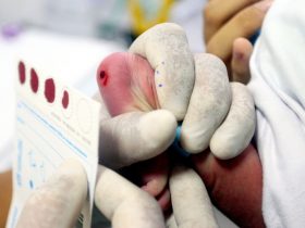 Hospital Iguassú realiza mais de 4,5 mil testes do pezinho desde inauguração